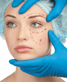 El lifting facial es un procedimiento destinado a mejorar los signos visibles del envejecimiento en la cara y el cuello.