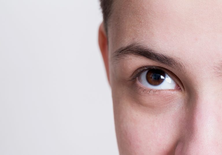 Ojeras