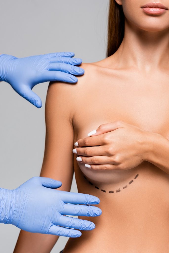 Evaluación clínica del pecho antes de mastopexia en Aranjuez