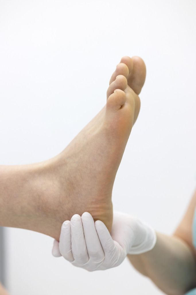 dolor en el pie plano adulto al caminar en Aranjuez