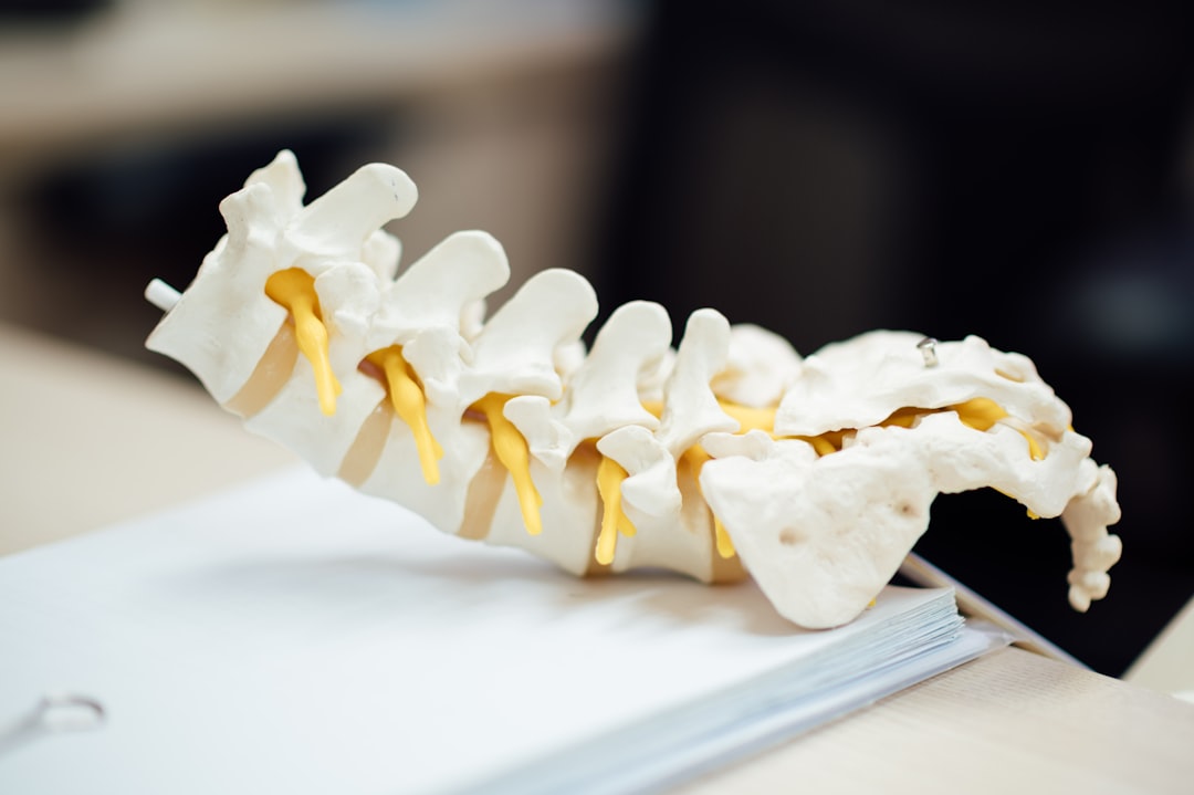 Sigo con ciática después de operarme de la hernia discal: qué es el síndrome postquirúrgico lumbar